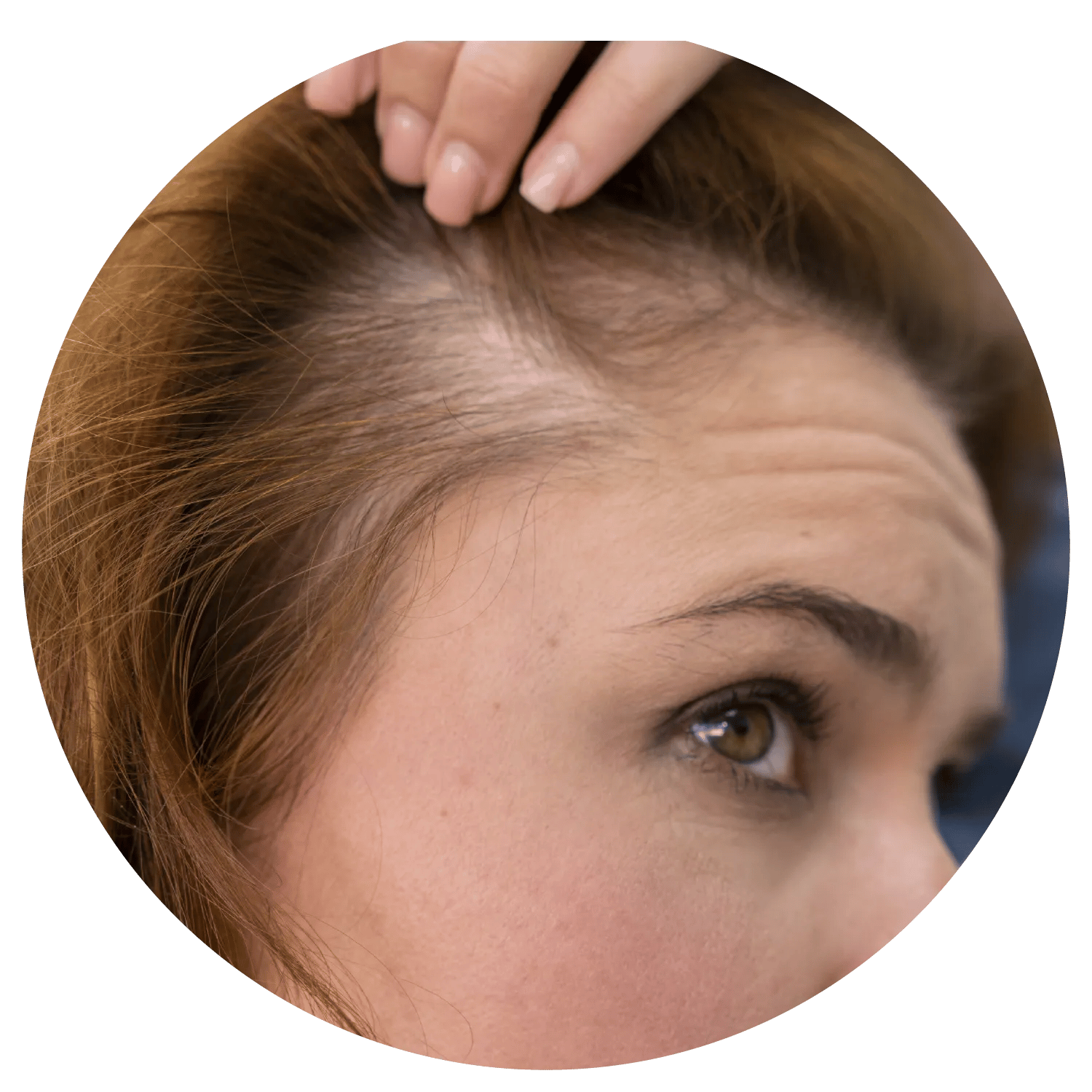 Hair Loss treatment process at Toronto medical spa - Understand the deeper roots of the hair loss